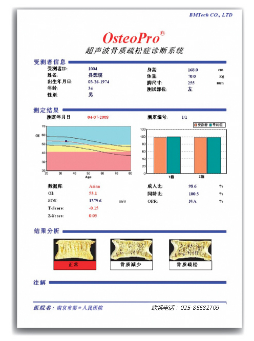 超聲骨密度檢測結(jié)果.jpg