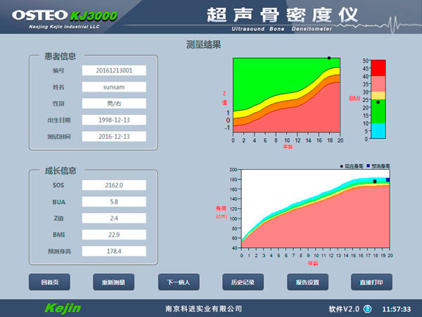 國(guó)產(chǎn)骨密度檢測(cè)結(jié)果值.jpg